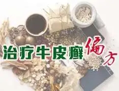 使用偏方治疗牛皮癣要注意什么