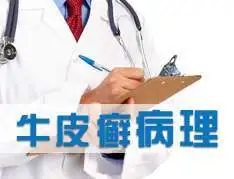 牛皮癣是由什么引起的呢