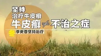 牛皮癣治疗要有恒心